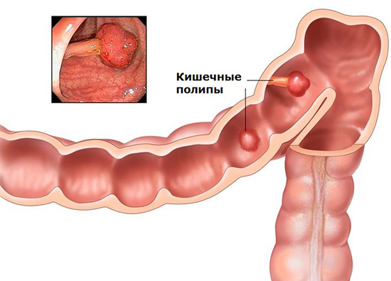 Что такое in situ в онкологии. Смотреть фото Что такое in situ в онкологии. Смотреть картинку Что такое in situ в онкологии. Картинка про Что такое in situ в онкологии. Фото Что такое in situ в онкологии