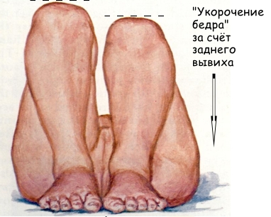 линия шентона прерывистая что значит. Смотреть фото линия шентона прерывистая что значит. Смотреть картинку линия шентона прерывистая что значит. Картинка про линия шентона прерывистая что значит. Фото линия шентона прерывистая что значит