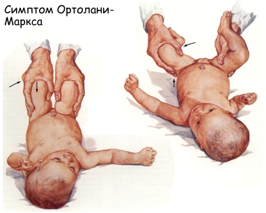 линия шентона прерывистая что значит. Смотреть фото линия шентона прерывистая что значит. Смотреть картинку линия шентона прерывистая что значит. Картинка про линия шентона прерывистая что значит. Фото линия шентона прерывистая что значит