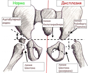 линия шентона прерывистая что значит. Смотреть фото линия шентона прерывистая что значит. Смотреть картинку линия шентона прерывистая что значит. Картинка про линия шентона прерывистая что значит. Фото линия шентона прерывистая что значит