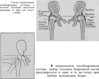 линия шентона прерывистая что значит. Смотреть фото линия шентона прерывистая что значит. Смотреть картинку линия шентона прерывистая что значит. Картинка про линия шентона прерывистая что значит. Фото линия шентона прерывистая что значит