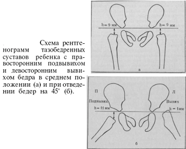 линия шентона прерывистая что значит. Смотреть фото линия шентона прерывистая что значит. Смотреть картинку линия шентона прерывистая что значит. Картинка про линия шентона прерывистая что значит. Фото линия шентона прерывистая что значит