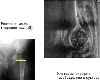 линия шентона прерывистая что значит. Смотреть фото линия шентона прерывистая что значит. Смотреть картинку линия шентона прерывистая что значит. Картинка про линия шентона прерывистая что значит. Фото линия шентона прерывистая что значит