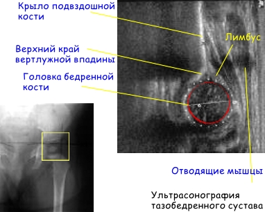 линия шентона прерывистая что значит. Смотреть фото линия шентона прерывистая что значит. Смотреть картинку линия шентона прерывистая что значит. Картинка про линия шентона прерывистая что значит. Фото линия шентона прерывистая что значит