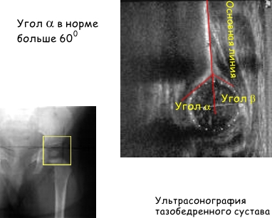 линия шентона прерывистая что значит. Смотреть фото линия шентона прерывистая что значит. Смотреть картинку линия шентона прерывистая что значит. Картинка про линия шентона прерывистая что значит. Фото линия шентона прерывистая что значит