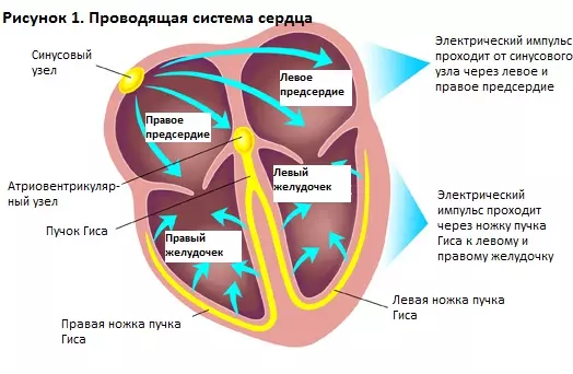 Синусно-предсердная блокада