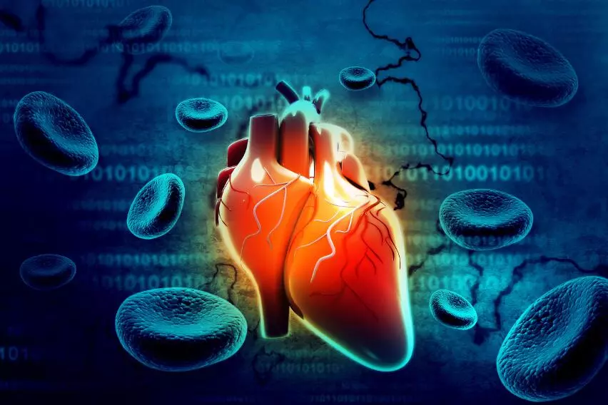 Кифосколиотическая болезнь сердца как разновидность легочного сердца