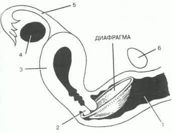 Диафрагмы как метод контрацепции