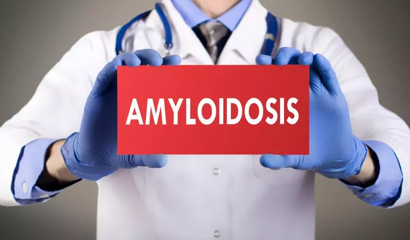 Что такое амилоидоз?