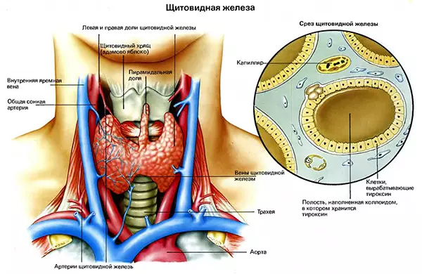 Эутиреоидный синдром, кровоизлияние в щитовидную железу