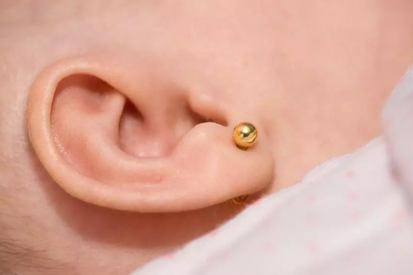 Холестеатома наружного уха