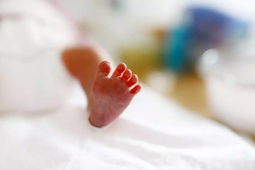 Врожденные миопатии, мышечная слабость у младенцев