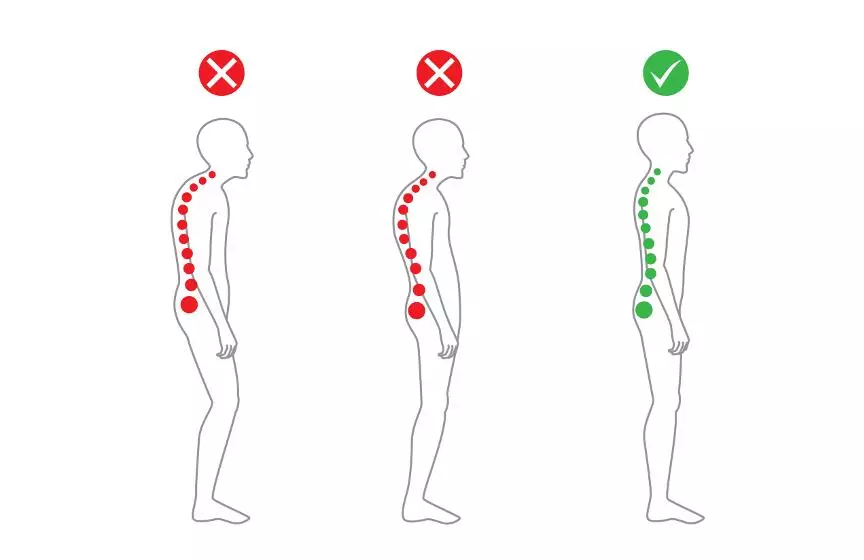 Осанка и телосложение, исправление осанки