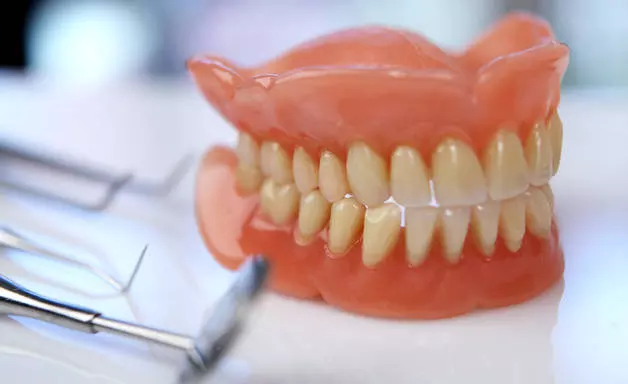 Съемные протезы или импланты для зубов