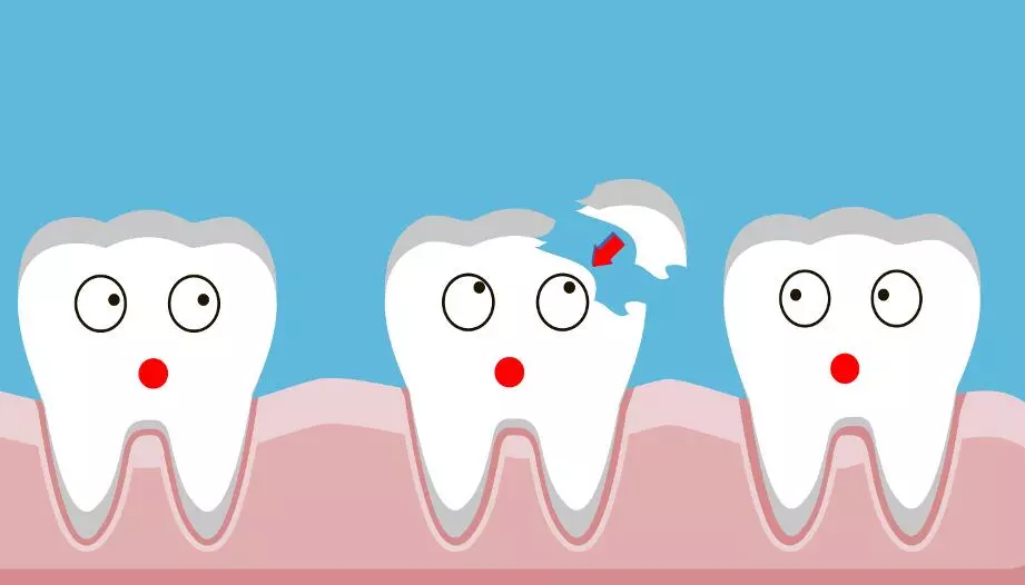 Аномалии зубочелюстной системы, аномалии зуба, прикуса