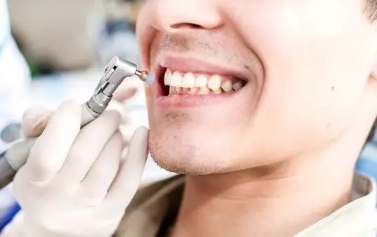 Профессиональная чистка: чтобы зубы оставались здоровыми
