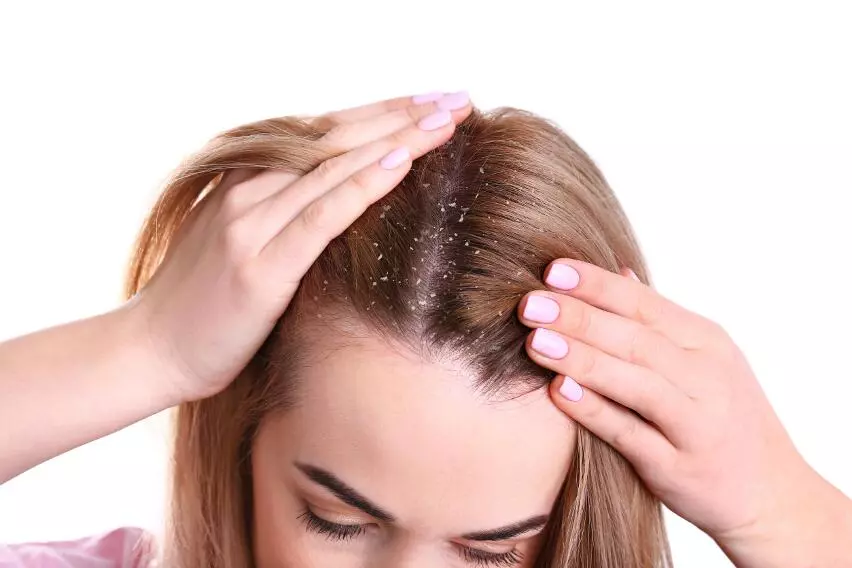 Перхоть и зуд: поможет ли скрабирование кожи головы?